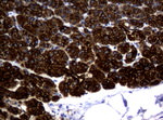 KRT18 Antibody in Immunohistochemistry (Paraffin) (IHC (P))