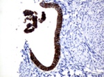KRT18 Antibody in Immunohistochemistry (Paraffin) (IHC (P))