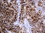 KRT18 Antibody in Immunohistochemistry (Paraffin) (IHC (P))