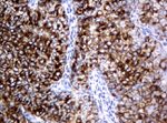 KRT18 Antibody in Immunohistochemistry (Paraffin) (IHC (P))