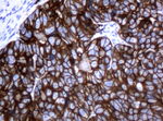KRT18 Antibody in Immunohistochemistry (Paraffin) (IHC (P))