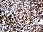 KRT18 Antibody in Immunohistochemistry (Paraffin) (IHC (P))