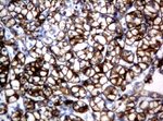KRT18 Antibody in Immunohistochemistry (Paraffin) (IHC (P))