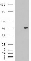 KRT18 Antibody in Western Blot (WB)