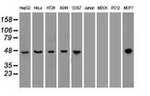 KRT18 Antibody in Western Blot (WB)