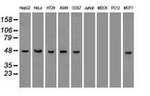 KRT18 Antibody in Western Blot (WB)