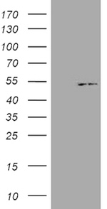KRT18 Antibody in Western Blot (WB)