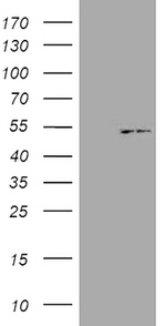 KRT18 Antibody in Western Blot (WB)