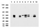 KRT18 Antibody in Western Blot (WB)