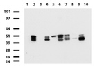 KRT18 Antibody in Western Blot (WB)