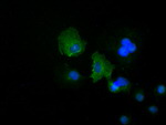 KRT19 Antibody in Immunocytochemistry (ICC/IF)