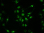 KRT19 Antibody in Immunocytochemistry (ICC/IF)