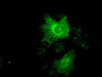 KRT19 Antibody in Immunocytochemistry (ICC/IF)