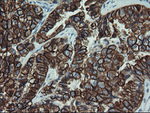 KRT19 Antibody in Immunohistochemistry (Paraffin) (IHC (P))