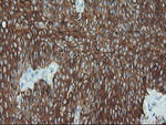 KRT19 Antibody in Immunohistochemistry (Paraffin) (IHC (P))