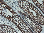 KRT19 Antibody in Immunohistochemistry (Paraffin) (IHC (P))