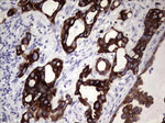 KRT19 Antibody in Immunohistochemistry (Paraffin) (IHC (P))