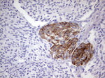 KRT19 Antibody in Immunohistochemistry (Paraffin) (IHC (P))