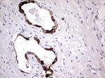 KRT19 Antibody in Immunohistochemistry (Paraffin) (IHC (P))