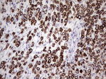 KRT19 Antibody in Immunohistochemistry (Paraffin) (IHC (P))