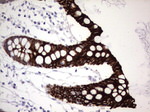 KRT19 Antibody in Immunohistochemistry (Paraffin) (IHC (P))