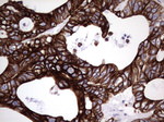 KRT19 Antibody in Immunohistochemistry (Paraffin) (IHC (P))