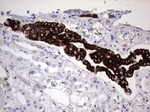 KRT19 Antibody in Immunohistochemistry (Paraffin) (IHC (P))