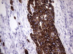 KRT19 Antibody in Immunohistochemistry (Paraffin) (IHC (P))