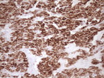 KRT19 Antibody in Immunohistochemistry (Paraffin) (IHC (P))