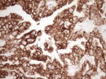 KRT19 Antibody in Immunohistochemistry (Paraffin) (IHC (P))