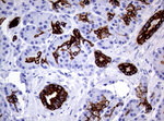 KRT19 Antibody in Immunohistochemistry (Paraffin) (IHC (P))