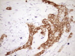 KRT19 Antibody in Immunohistochemistry (Paraffin) (IHC (P))