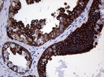 KRT19 Antibody in Immunohistochemistry (Paraffin) (IHC (P))
