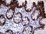 KRT19 Antibody in Immunohistochemistry (Paraffin) (IHC (P))