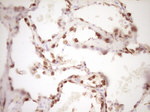 KRT19 Antibody in Immunohistochemistry (Paraffin) (IHC (P))