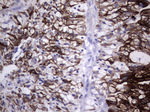 KRT19 Antibody in Immunohistochemistry (Paraffin) (IHC (P))