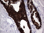 KRT19 Antibody in Immunohistochemistry (Paraffin) (IHC (P))