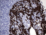 KRT19 Antibody in Immunohistochemistry (Paraffin) (IHC (P))