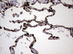 KRT19 Antibody in Immunohistochemistry (Paraffin) (IHC (P))