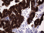 KRT19 Antibody in Immunohistochemistry (Paraffin) (IHC (P))