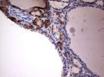 KRT19 Antibody in Immunohistochemistry (Paraffin) (IHC (P))