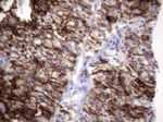KRT19 Antibody in Immunohistochemistry (Paraffin) (IHC (P))