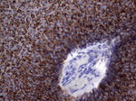 KRT19 Antibody in Immunohistochemistry (Paraffin) (IHC (P))