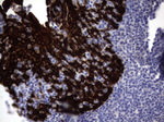 KRT19 Antibody in Immunohistochemistry (Paraffin) (IHC (P))