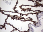 KRT19 Antibody in Immunohistochemistry (Paraffin) (IHC (P))