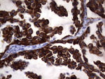 KRT19 Antibody in Immunohistochemistry (Paraffin) (IHC (P))