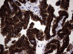 KRT19 Antibody in Immunohistochemistry (Paraffin) (IHC (P))