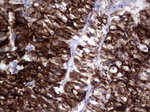 KRT19 Antibody in Immunohistochemistry (Paraffin) (IHC (P))