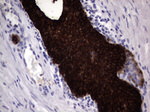 KRT19 Antibody in Immunohistochemistry (Paraffin) (IHC (P))