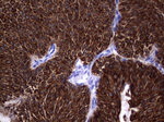 KRT19 Antibody in Immunohistochemistry (Paraffin) (IHC (P))